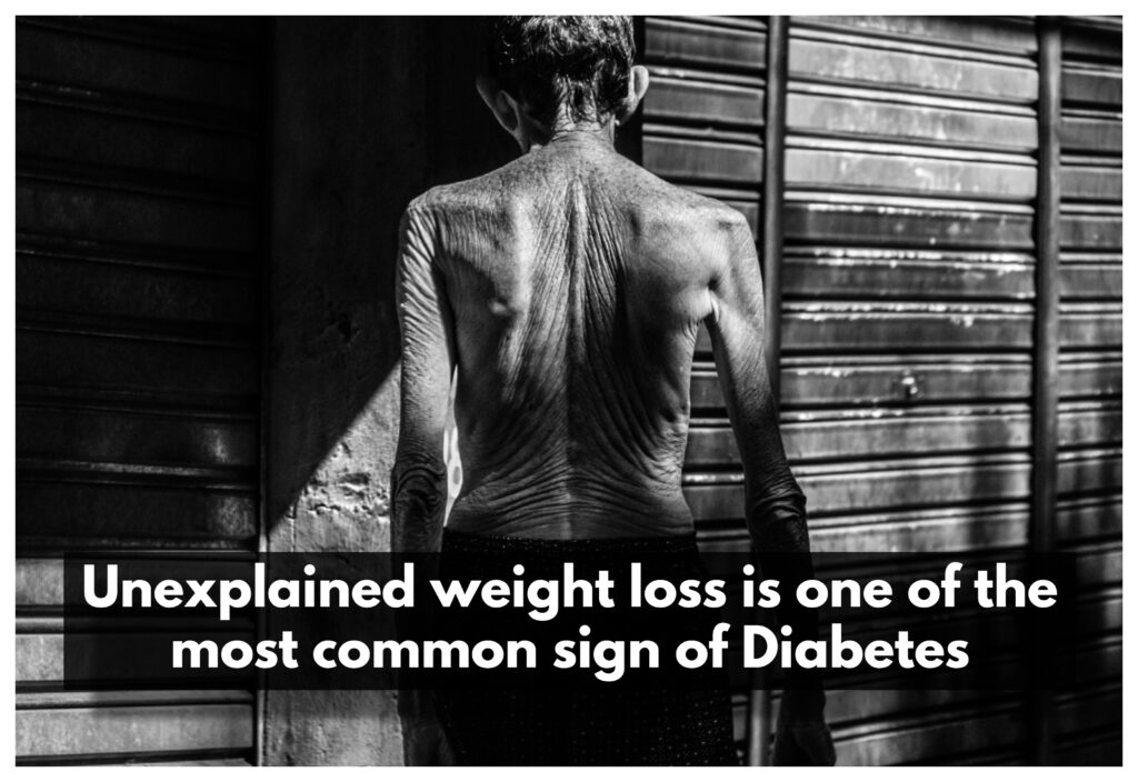 A decrease in body weight without an identifiable cause may be indicative of Diabetes.