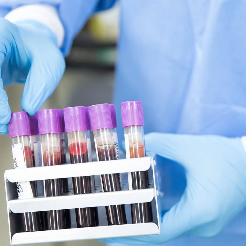 A Breakthrough in Alzheimer’s Detection: Simpler, Sooner, and More Accessible