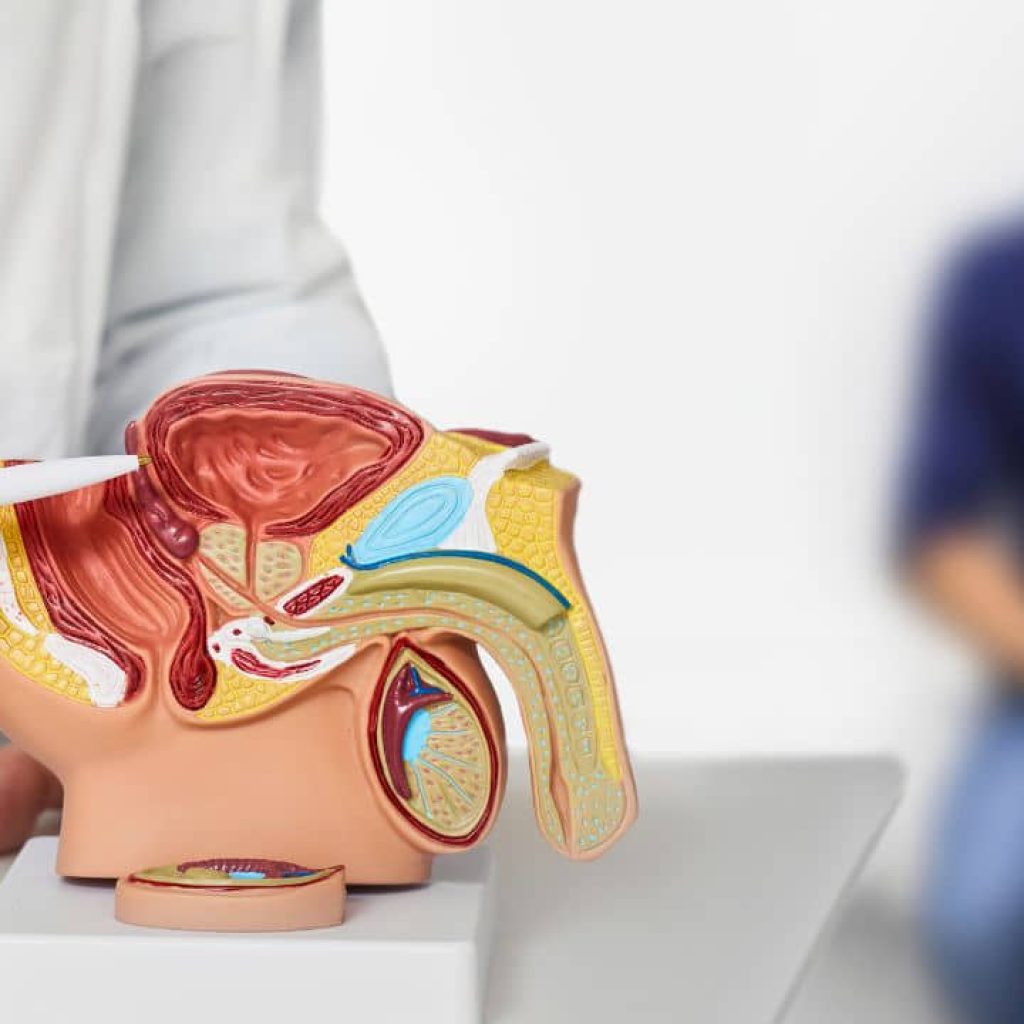 An image of a person showing a model of the prostate gland.