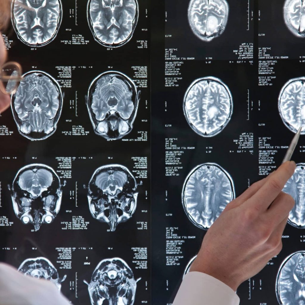 One MRI, One Snapshot — and Insights Into Your Aging Journey