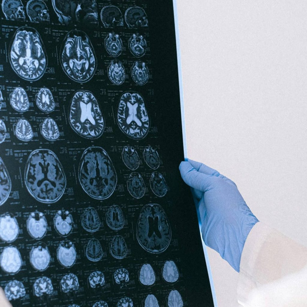 Could One Protein Unlock a Younger Brain?
